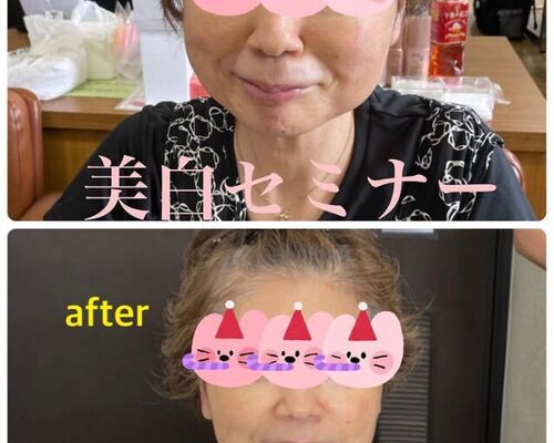 ビフォーアフター