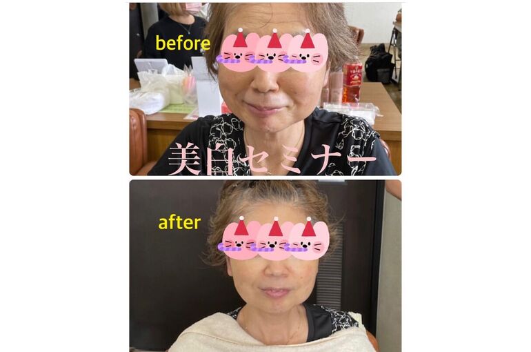 ビフォーアフター